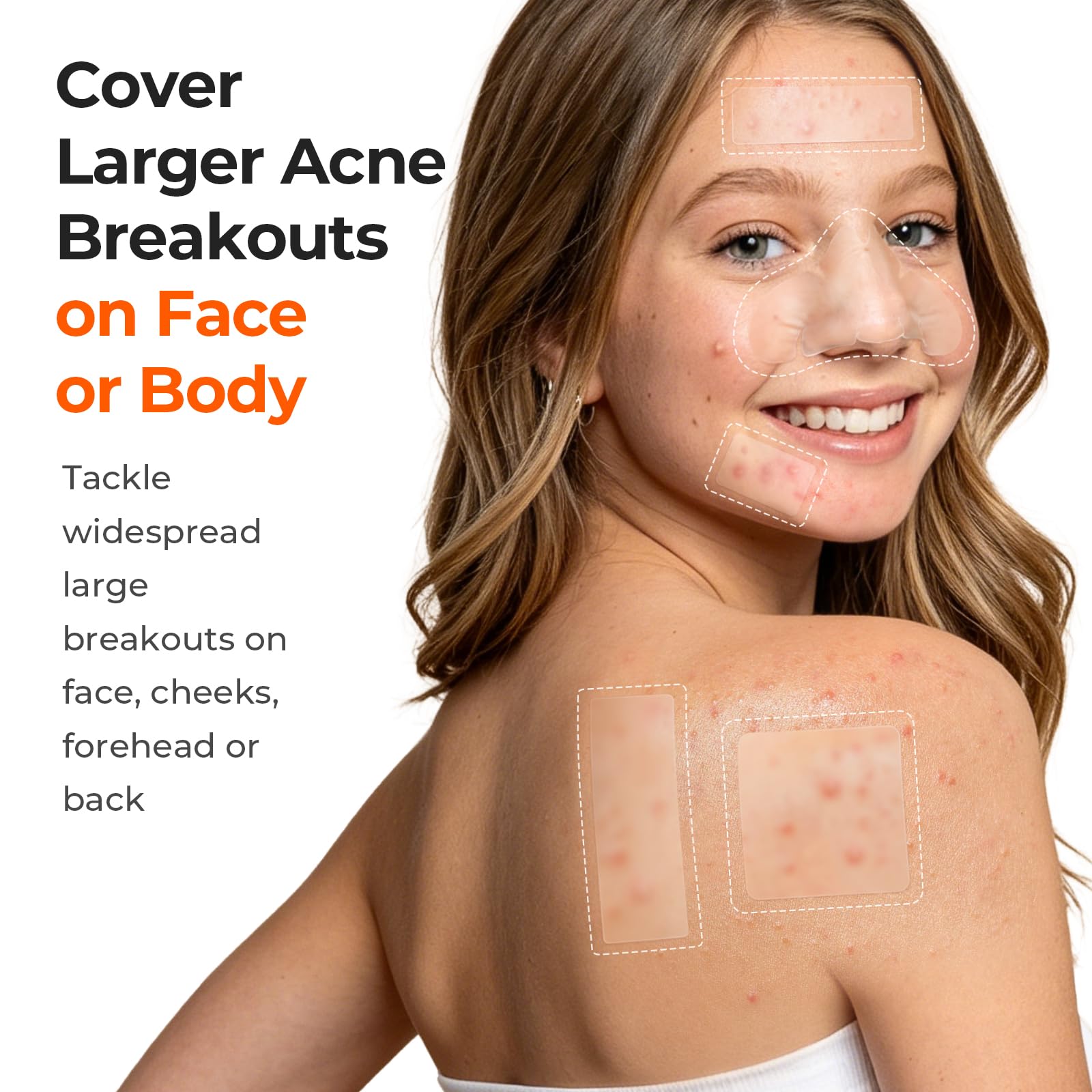 TKTK 443 Count Pimple Patches for Face, Hydrocolloid Acne Patch Bulk, Acne Stickers for Covering Cheeks, Forehead, Chin Blemishes Zit Breakouts for All Skin Types (Dots, Strip, Contoured 5 Sizes)